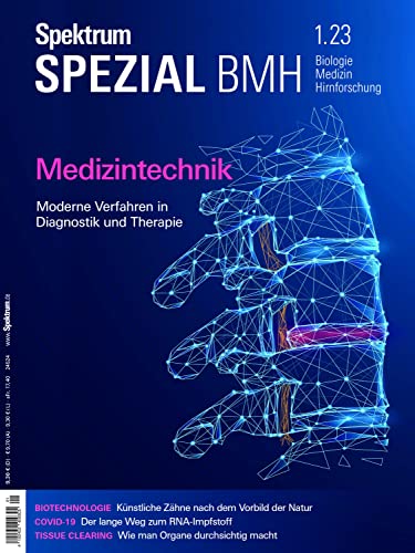 Spektrum Spezial - Medizintechnik: Moderne Verfahren in Diagnostik und Therapie (Spektrum Spezial - Biologie, Medizin, Hirnforschung) von Spektrum der Wissenschaft
